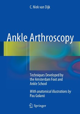 Ankle Arthroscopy