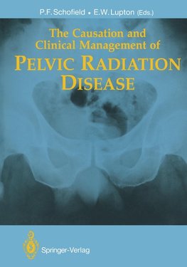 The Causation and Clinical Management of Pelvic Radiation Disease