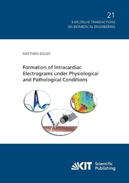 Formation of Intracardiac Electrograms under Physiological and Pathological Conditions