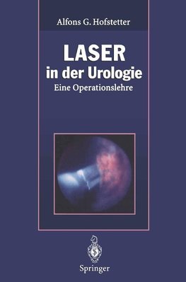 Laser in der Urologie