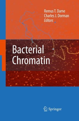 Bacterial Chromatin