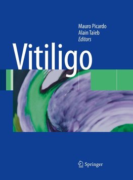 Vitiligo