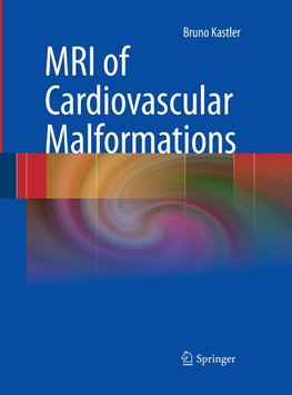 MRI of Cardiovascular Malformations