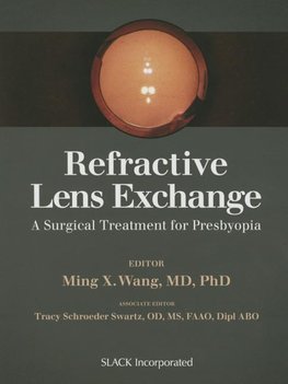 Wang, M:  Refractive Lens Exchange