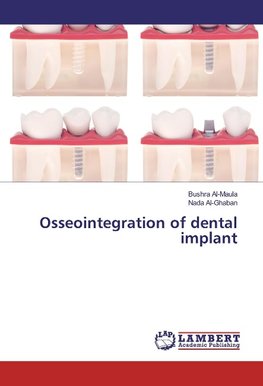 Osseointegration of dental implant