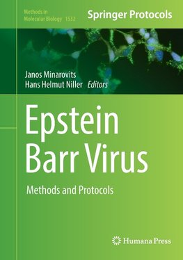 Epstein Barr Virus