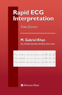 Rapid ECG Interpretation