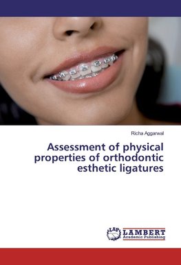 Assessment of physical properties of orthodontic esthetic ligatures