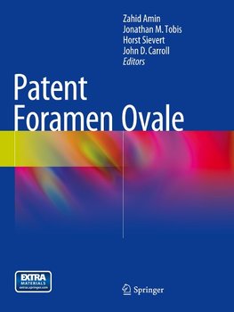 Patent Foramen Ovale