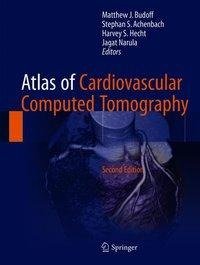 Atlas of Cardiovascular Computed Tomography