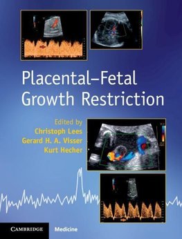 Placental-Fetal Growth Restriction