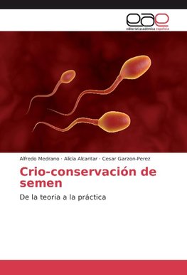 Crio-conservación de semen