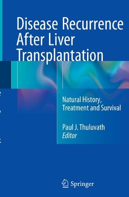 Disease Recurrence After Liver Transplantation