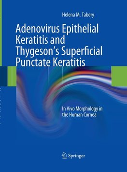 Adenovirus Epithelial Keratitis and Thygeson's Superficial Punctate Keratitis