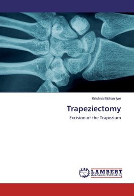 Trapeziectomy