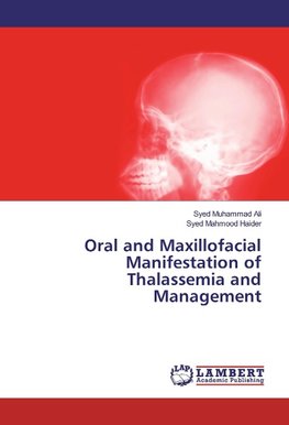 Oral and Maxillofacial Manifestation of Thalassemia and Management