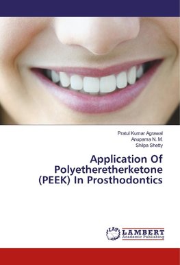 Application Of Polyetheretherketone (PEEK) In Prosthodontics