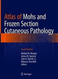 Atlas of Mohs and Frozen Section Cutaneous Pathology