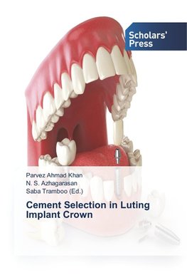 Cement Selection in Luting Implant Crown