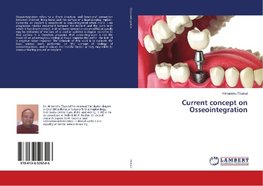 Current concept on Osseointegration