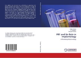 PRF and Its Role in Implantology