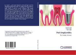 Peri-implantitis