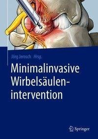 Minimalinvasive Wirbelsäulenintervention