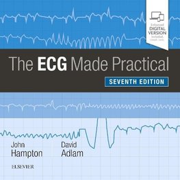 The ECG Made Practical