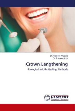 Crown Lengthening