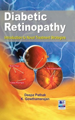 Diabetic Retinopathy