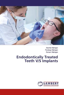 Endodontically Treated Teeth V/S Implants