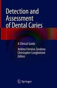 Detection and Assessment of Dental Caries