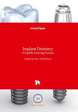 Implant Dentistry