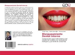 Blanqueamiento Dental Interno