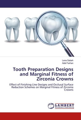 Tooth Preparation Designs and Marginal Fitness of Zirconia Crowns