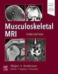 Musculoskeletal MRI, 3rd Edition