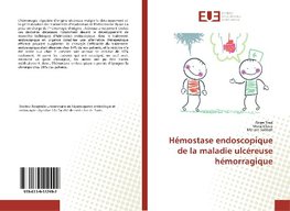 Hémostase endoscopique de la maladie ulcéreuse hémorragique