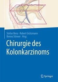 Chirurgie des Kolonkarzinoms