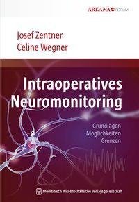 Intraoperatives Neuromonitoring