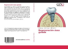 Regeneración ósea guiada