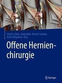 Offene Hernienchirurgie