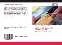 Carillas de laminado: Ciencia y Arte