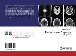 Medical Image Processing Using IDL