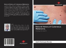 Natural History of Cutaneous Melanoma.