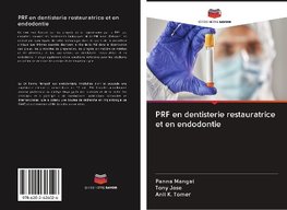 PRF en dentisterie restauratrice et en endodontie