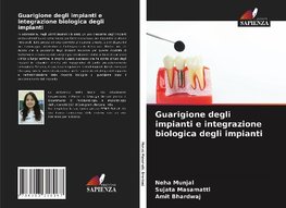 Guarigione degli impianti e integrazione biologica degli impianti