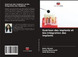 Guérison des implants et bio-intégration des implants