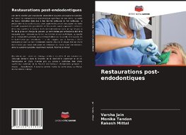 Restaurations post-endodontiques