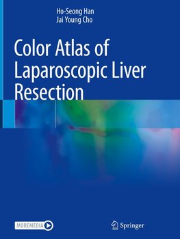 Color Atlas of Laparoscopic Liver Resection