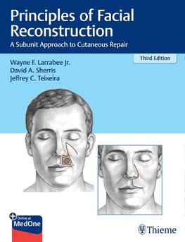 Principles of Facial Reconstruction